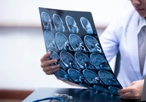 Stroke explained: Recognise the warning signs and act fast
